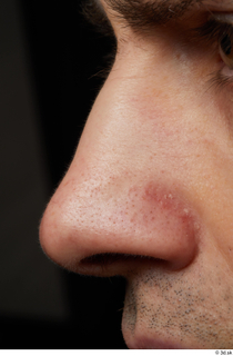 HD Face skin references Josh Hart nose skin pores skin…